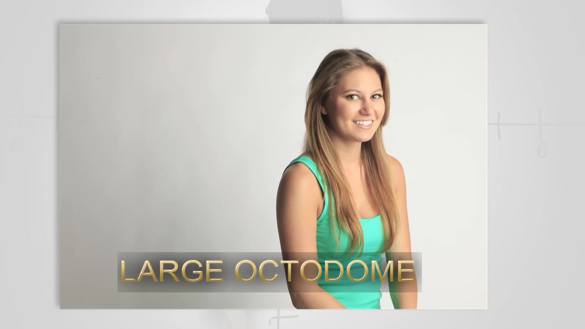 Large octodome on subject with zero wall shadow visible